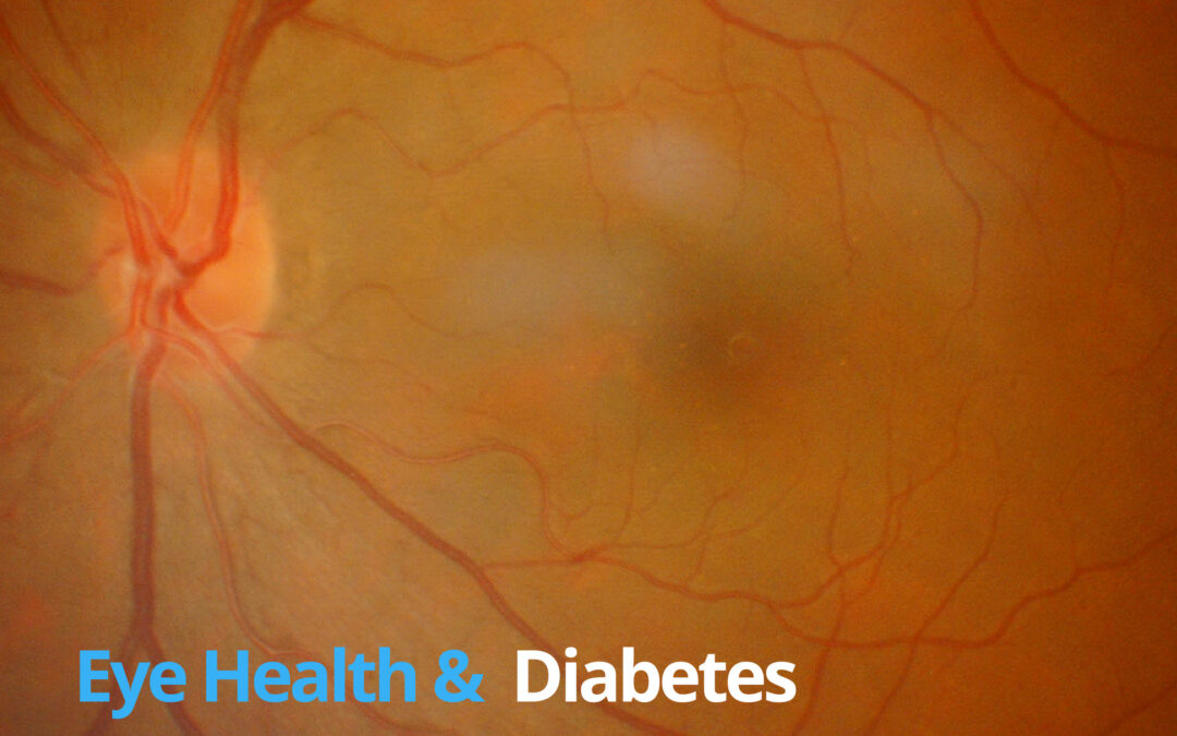 Eye Health and Diabetes