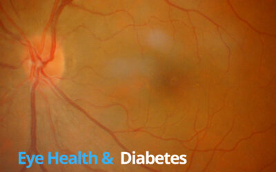 Safeguarding Your Vision: Understanding Diabetes and Eye Health