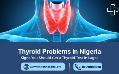 Thyroid Problems: Signs You Should Get a Thyroid Test